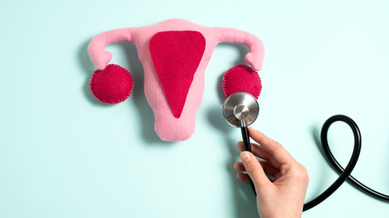 PCOS vizsgálat menete és a diagnózis gyakorlata